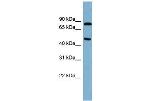 WB Suggested Anti-PANK4 Antibody Titration: 0. (PANK4 Antikörper  (N-Term))