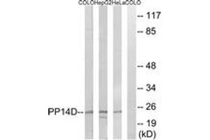 Western Blotting (WB) image for anti-Protein Phosphatase 1, Regulatory (Inhibitor) Subunit 14D (PPP1R14D) (AA 66-115) antibody (ABIN1535220)