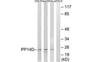 Western blot analysis of extracts from HeLa/HepG2/COLO cells, using PPP1R14D Antibody.