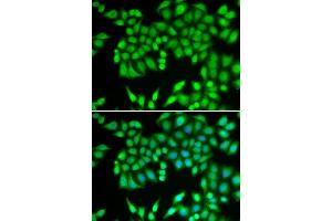 Immunofluorescence analysis of U2OS cell using MCM3 antibody. (MCM3 Antikörper)