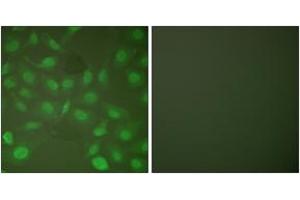 Immunofluorescence analysis of HepG2 cells, using C/EBP-beta (Phospho-Thr235/188) Antibody. (CEBPB Antikörper  (pThr235))