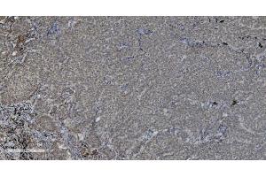 IHC analysis of PARP using anti-PARP antibody (ABIN7602277). (PARP1 Antikörper  (AA 670-858))