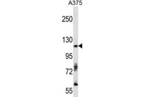 Western Blotting (WB) image for anti-AXL Receptor tyrosine Kinase (AXL) antibody (ABIN3003321) (AXL Antikörper)