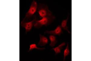 ABIN6269097 staining 293 by IF/ICC. (KRT8 Antikörper  (C-Term))