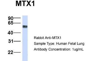 Host:  Rabbit  Target Name:  MTX1  Sample Type:  Human Fetal Lung  Antibody Dilution:  1. (Metaxin 1 Antikörper  (C-Term))