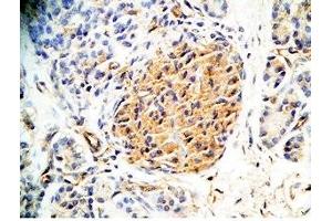 Immunohistochemistry (IHC) image for anti-Chromosome 2 Open Reading Frame 40 (C2orf40) (AA 133-148), (Preproprotein) antibody (ABIN2873087)