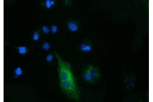 Anti-FSHB mouse monoclonal antibody (ABIN2453055) immunofluorescent staining of COS7 cells transiently transfected by pCMV6-ENTRY FSHB (RC214616). (FSHB Antikörper)