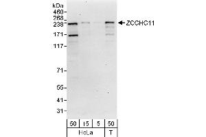 anti-Zinc Finger, CCHC Domain Containing 11 (ZCCHC11) (AA 1-50) antibody