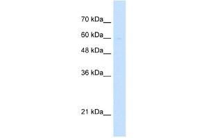 WB Suggested Anti-LETM1 Antibody Titration:  5. (LETM1 Antikörper  (Middle Region))