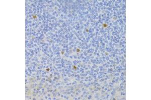 Immunohistochemistry of paraffin-embedded human tonsil using FCN1 Antibody (ABIN5973958) at dilution of 1/100 (40x lens). (FCN1 Antikörper)