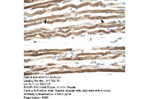 Immunohistochemistry (IHC) image for anti-Nuclear Factor of Activated T-Cells, Cytoplasmic, Calcineurin-Dependent 4 (NFATC4) (Middle Region) antibody (ABIN2777543)