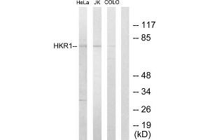 Western blot analysis of extracts from HeLa cells, Jurkat cells and COLO205 cells, using HKR1 antibody. (HKR1 Antikörper  (Internal Region))