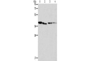 Western Blotting (WB) image for anti-Branched Chain Amino-Acid Transaminase 2, Mitochondrial (BCAT2) antibody (ABIN2422985) (BCAT2 Antikörper)