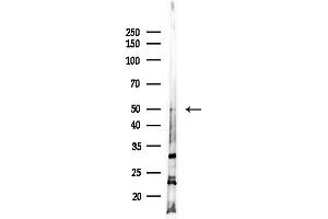Western blot analysis of lysates from Hela cells(starvation,24h treatment), using Cytochrome P450 4X1 Antibody at 1/1000 dilution.