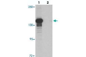 Western blot analysis of KDM6B in K-562 cell lysate with KDM6B polyclonal antibody  at 0. (Kdm6b Antikörper  (N-Term))