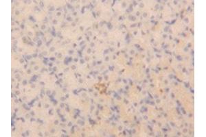 Immunohistochemistry (IHC) image for anti-Natriuretic Peptide A (NPPA) (AA 25-152) antibody (ABIN7445444)