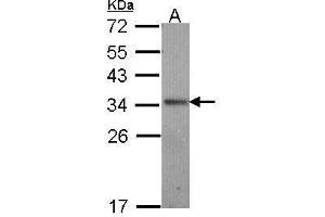 WB Image Sample (30 ug of whole cell lysate) A: A431 , 12% SDS PAGE antibody diluted at 1:1000 (IL-24 Antikörper  (C-Term))