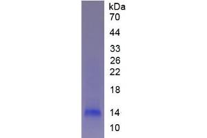 SDS-PAGE analysis of Human Fibrinogen alpha Protein. (FGA Protein)