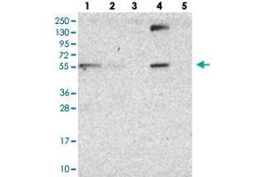 Western blot analysis of Lane 1: RT-4, Lane 2: U-251 MG, Lane 3: Human Plasma, Lane 4: Liver, Lane 5: Tonsil with DUS2L polyclonal antibody  at 1:100-1:250 dilution. (DUSL2 Antikörper)