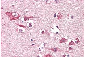 Anti-PLCG1 antibody IHC staining of human brain, cortex. (Phospholipase C gamma 1 Antikörper)
