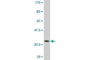 Western Blot detection against Immunogen (37. (CTHRC1 Antikörper  (AA 32-141))