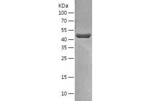 SNX5 Protein (AA 1-404) (His tag)