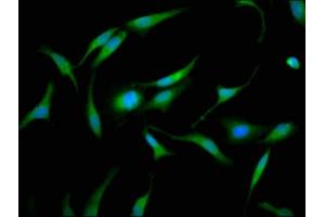 Immunofluorescence staining of Hela cells with ABIN7153745 at 1:133, counter-stained with DAPI.