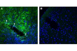 Expression of GPR143 in mouse striatum.
