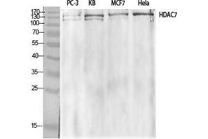 Western Blot (WB) analysis of specific cells using HDAC7 Polyclonal Antibody. (HDAC7 Antikörper  (Tyr721))