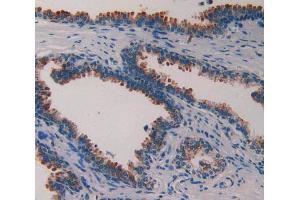 IHC-P analysis of prostate gland tissue, with DAB staining. (PLAA Antikörper  (AA 534-792))