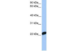 WB Suggested Anti-F10 Antibody Titration:  0. (Coagulation Factor X Antikörper  (C-Term))