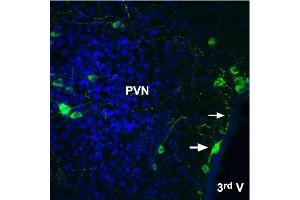 Expression of Angiotensin II receptor type-2 in rat brain - Immunohistochemical staining of rat frozen free floating brain sections using Anti-Angiotensin II Receptor Type-2 (extracellular)-ATTO Fluor-488 Antibody (ABIN7042926), (1:20). (Angiotensin II Type 2 Receptor Antikörper  (Extracellular) (Atto 488))