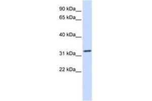 Image no. 1 for anti-Tropomyosin alpha-1 Chain (TM7) (C-Term) antibody (ABIN6743064) (TM7 Antikörper  (C-Term))