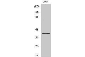 Western Blotting (WB) image for anti-GATA Binding Protein 1 (Globin Transcription Factor 1) (GATA1) (pSer310) antibody (ABIN3182019) (GATA1 Antikörper  (pSer310))