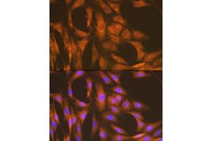 Immunofluorescence analysis of C6 cells using U Rabbit mAb (ABIN7271211) at dilution of 1:100 (40x lens). (UAP1 Antikörper)
