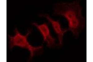 Immunofluorescence (fixed cells) (IF/ICC) image for anti-Amyloid beta (A4) Precursor Protein (APP) (C-Term) antibody (ABIN6259922)