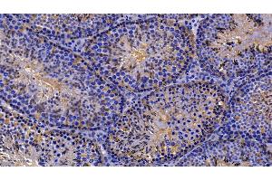 Detection of PRDX2 in Mouse Testis Tissue using Polyclonal Antibody to Peroxiredoxin 2 (PRDX2) (Peroxiredoxin 2 Antikörper  (AA 6-164))