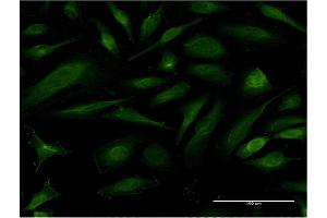 Immunofluorescence of monoclonal antibody to EIF1AY on HeLa cell. (EIF1AY Antikörper  (AA 31-120))