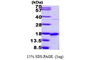 Small Nuclear Ribonucleoprotein D2 Polypeptide 16.5kDa (SNRPD2) (AA 1-118) protein (His tag)