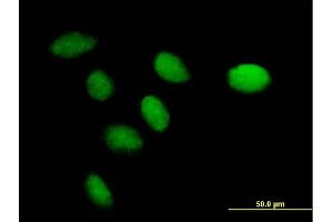 Immunofluorescence of purified MaxPab antibody to CENPK on HeLa cell. (CENPK Antikörper  (AA 1-269))