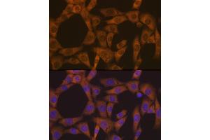 Immunofluorescence analysis of NIH-3T3 cells using CAD Rabbit mAb (ABIN7266064) at dilution of 1:100 (40x lens). (CAD Antikörper)