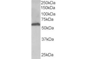 Western Blotting (WB) image for anti-Formiminotransferase Cyclodeaminase (FTCD) (N-Term) antibody (ABIN2465215) (FTCD Antikörper  (N-Term))