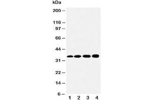 Western blot testing of HSD17B1 antibody and Lane 1:  rat kidney;  2: rat liver;  3: 293T;  4: HeLa cell lysate