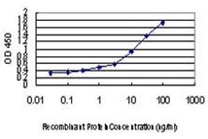 Detection limit for recombinant GST tagged AGR2 is approximately 0.