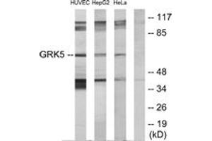 Western blot analysis of extracts from HeLa/HepG2/HuvEc cells, using GRK5 Antibody. (GRK5 Antikörper  (AA 351-400))