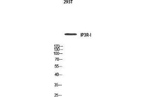 Western Blot (WB) analysis of 293T using IP3R-I antibody. (ITPR1 Antikörper)