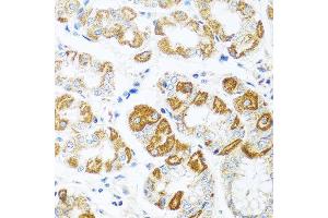 Immunohistochemistry of paraffin-embedded human stomach using CCL2 antibody at dilution of 1:100 (40x lens). (CCL2 Antikörper)