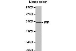 Western Blotting (WB) image for anti-Interferon Regulatory Factor 4 (IRF4) (AA 150-350) antibody (ABIN1680506) (IRF4 Antikörper  (AA 150-350))