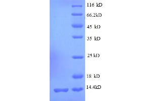 SDS-PAGE (SDS) image for Ribosomal Protein S19 (RPS19) (AA 2-92) protein (His tag) (ABIN5712600)
