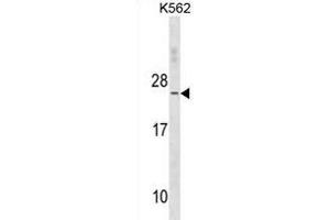 TNNC2 Antibody (C-term) (ABIN1881894 and ABIN2838656) western blot analysis in K562 cell line lysates (35 μg/lane). (TNNC2 Antikörper  (C-Term))